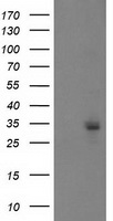 PGAM2 Antibody