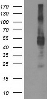 TMPRSS5 Antibody