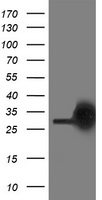 PGAM2 Antibody