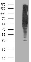 Lipoamide Dehydrogenase Antibody