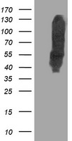 Lipoamide Dehydrogenase Antibody