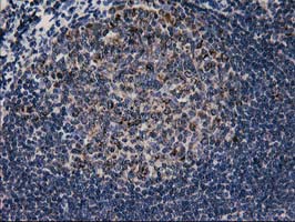 CCM2 Antibody