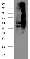 Lipoamide Dehydrogenase Antibody