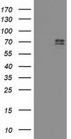 TFIIF Antibody