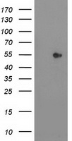 CARKL Antibody