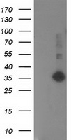 SIRT5 Antibody