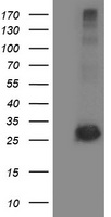 SIRT5 Antibody