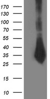 SIRT5 Antibody