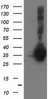 SIRT5 Antibody