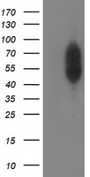 PHF21B Antibody