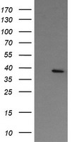 NUDT9 Antibody