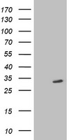 SIRT5 Antibody