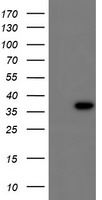 CBR3 Antibody