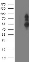 PHF21B Antibody
