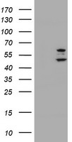 PHF21B Antibody