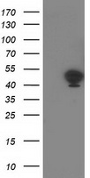 Tropomodulin 1 Antibody