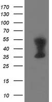 Tropomodulin 1 Antibody
