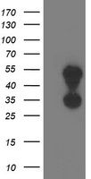 Tropomodulin 1 Antibody