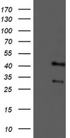 TMOD1 Antibody