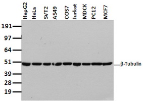 beta IV Tubulin Antibody