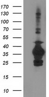 SULT1C2 Antibody