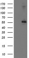 PPM1B Antibody