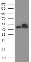 TUBB4A Antibody