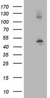 TUBB4A Antibody