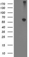 ADH1B Antibody