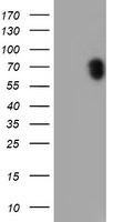 RPS6KB1 Antibody