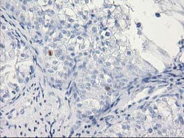 C1orf50 Antibody