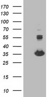 Monoacylglycerol Lipase Antibody
