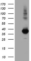 Monoacylglycerol Lipase Antibody