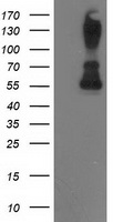 PPM1B Antibody