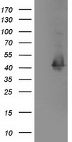 MAPRE2 Antibody