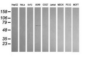ALDH1A3 Antibody