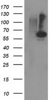 PPM1B Antibody