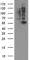 PPM1B Antibody