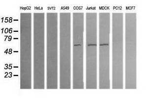 ALDH1A3 Antibody