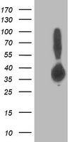 ALDOB Antibody