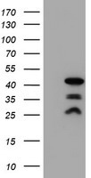 PDLIM2 Antibody
