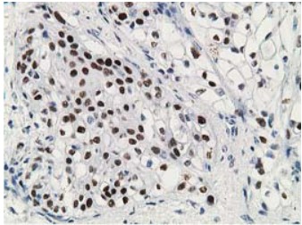 p53 Antibody