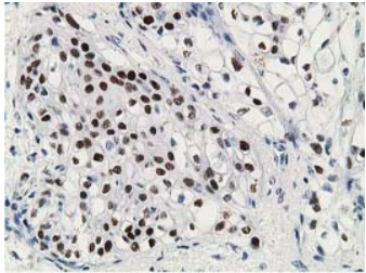 p53 (TP53) antibody