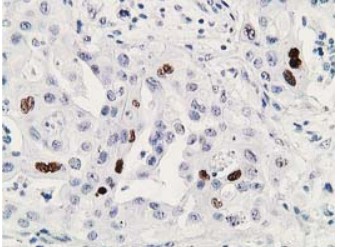 p53 Antibody
