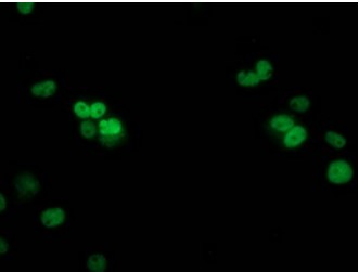 p53 Antibody