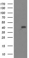 ADH1B Antibody