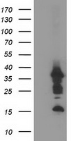 PDLIM2 Antibody
