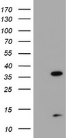 PDLIM2 Antibody