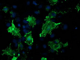 VASP Antibody