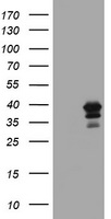 MAGEB18 Antibody